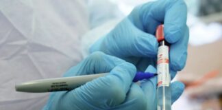 В Иркутской области выявили 53 случая коронавируса за сутки