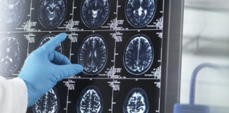 В России после пандемии COVID-19 не зафиксировали подъём психических заболеваний