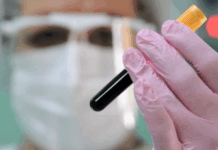 Вирусолог объяснил значение выявления случая двухлетнего заражения ковидом