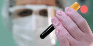 Вирусолог объяснил значение выявления случая двухлетнего заражения ковидом