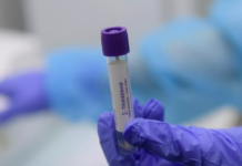 В Калуге выявили самый продолжительный случай заражения коронавирусом