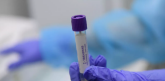 В Калуге выявили самый продолжительный случай заражения коронавирусом